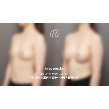 Where to Get Excellent Breast Surgery: You Need a Result That Fits You, Not Just a Before-and-After image 1