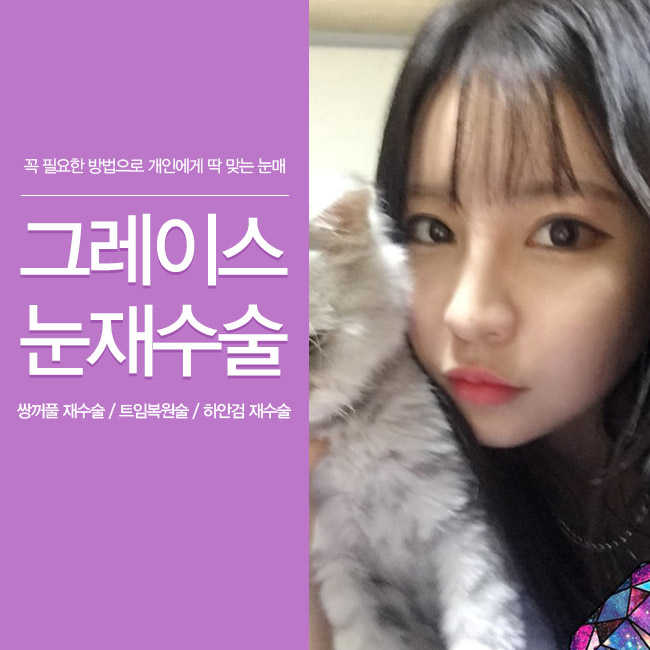 그레이스성형외과 눈재수술에 대해 알아보자! 관련 이미지 3