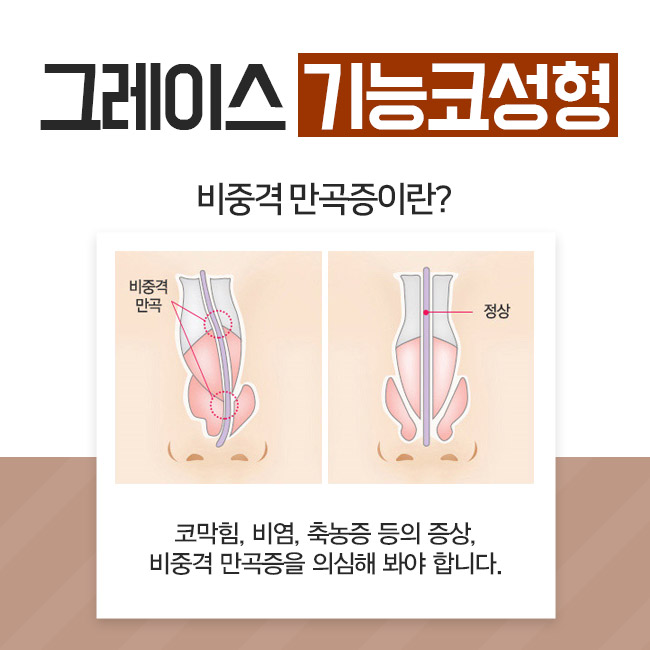 If You’re Looking Into the Cost of Septoplasty Surgery image 3