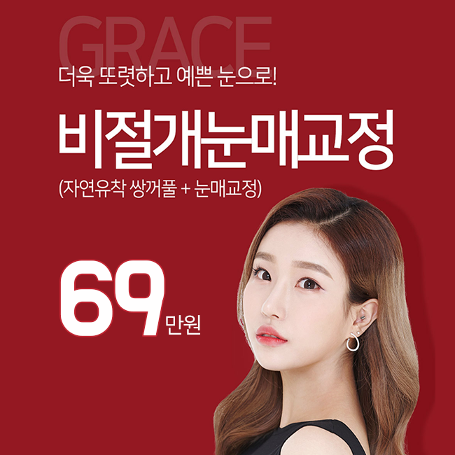비절개눈매교정가격 바로 여기서 부담없이 관련 이미지 5