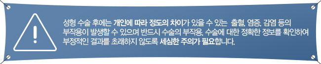 그레이스성형외과 눈재수술, 만족스러운 결과로 소문난 곳! 관련 이미지 7