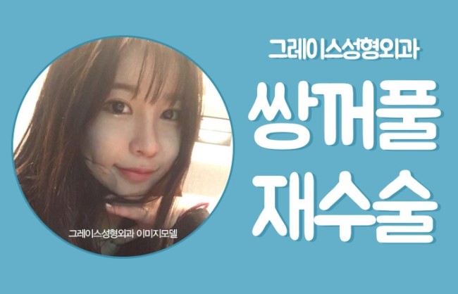 쌍꺼풀재수술은 신사역 그레이스성형외과에서! 관련 이미지 4