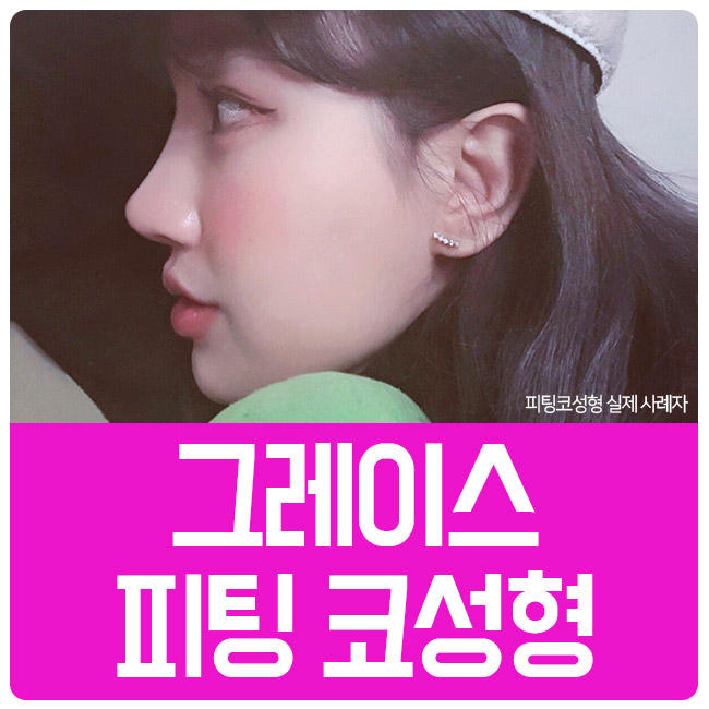 합리적인 코수술비용과 만족스러운 코수술후기까지 관련 이미지 1