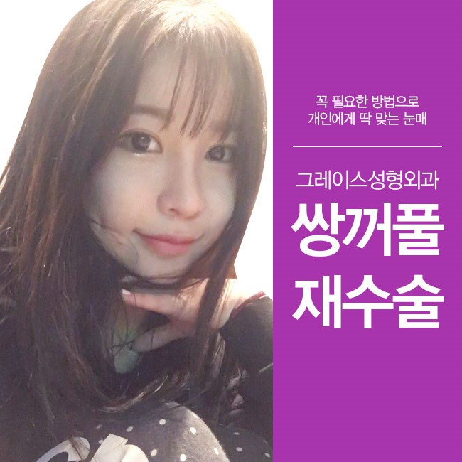 나에게 꼭 필요한 방법으로 그레이스성형외과 쌍꺼풀재수술 관련 이미지 1