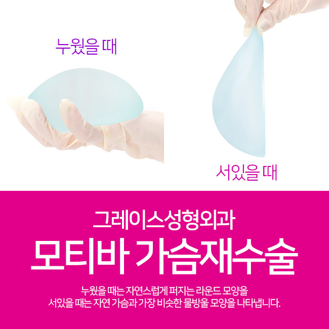 그레이스성형외과 모티바가슴재수술 첫 수술 비용 그대로 관련 이미지 3