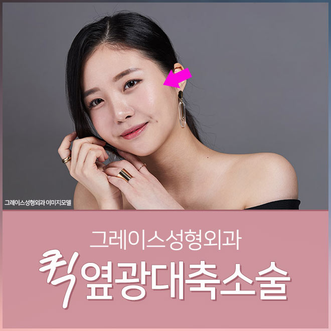 퀵옆광대효과 직접 확인해보세요 관련 이미지 1