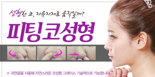 코성형의 고정관념을 깨다! 그레이스성형외과 피팅코 관련 이미지 4