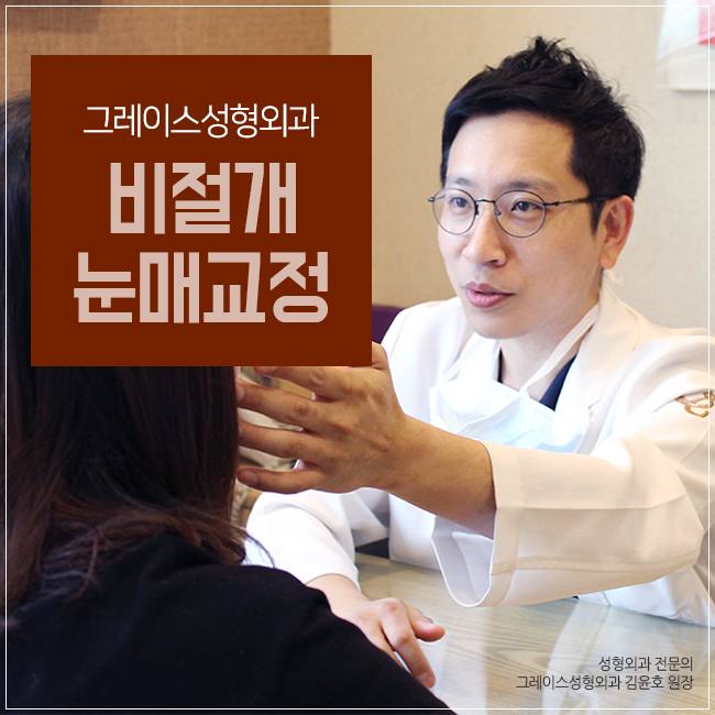 비절개눈매교정가격 바로 여기서 부담없이 관련 이미지 2