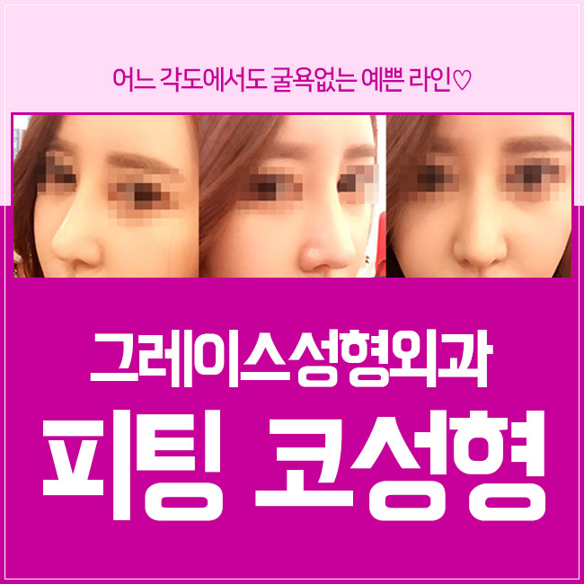 합리적인 코수술비용과 만족스러운 코수술후기까지 관련 이미지 3