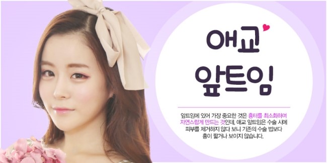앞트임후기, 그레이스성형외과에서 알아보자! 관련 이미지 3