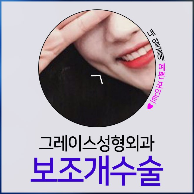매력적인 웃음의 포인트, 보조개수술방법 관련 이미지 2