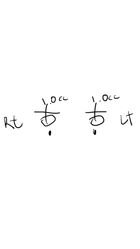 돌출눈·눈위 꺼짐으로 고생하는 사람이라면? 관련 이미지 2