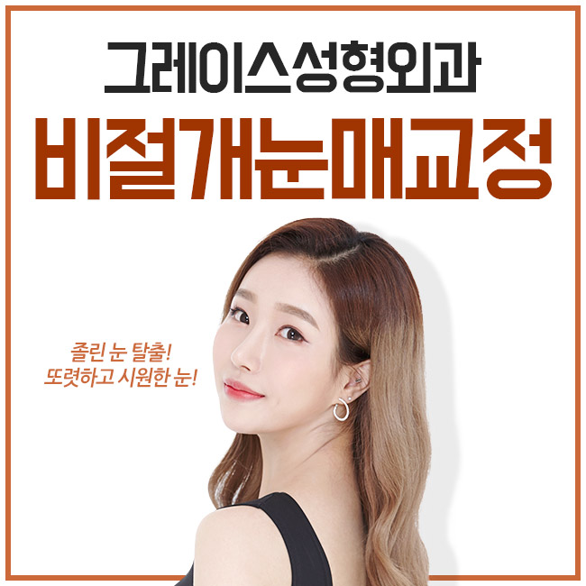 또렷한 눈의 비결, 비절개눈매교정♡ 관련 이미지 1