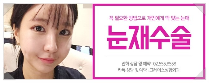 눈재수술 그레이스성형외과에서 알아보기! 관련 이미지 5