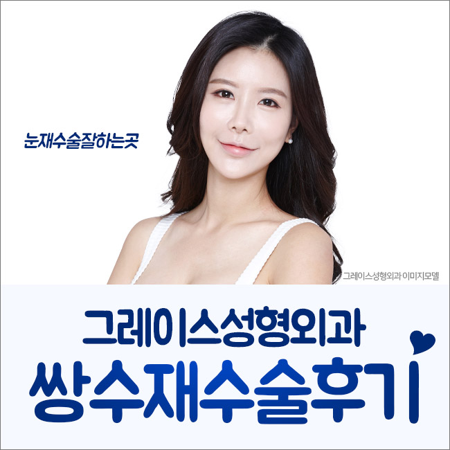 쌍수재수술후기 만족스러운 결과를 위한 선택 관련 이미지 4