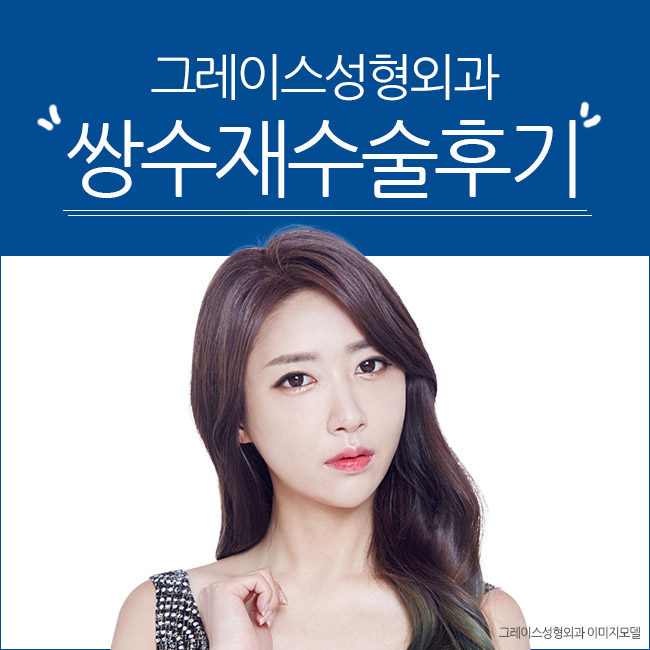 쌍수재수술후기 이곳이 정답인 이유 관련 이미지 2