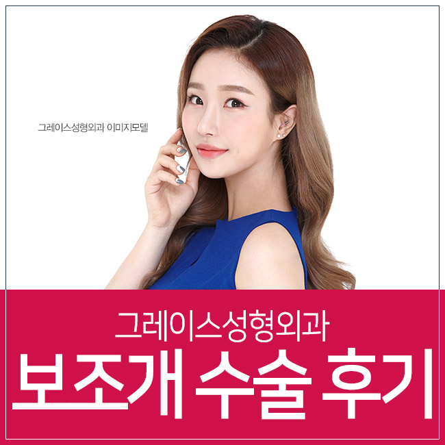 성공한 보조개수술후기를 찾고있다면? 이곳이 정답! 관련 이미지 2