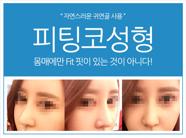 코성형잘하는병원 그레이스성형외과에서 피팅코로 오똑하게! 관련 이미지 3