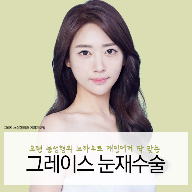 눈재수술명의, 신사역 그레이스성형외과 최문섭원장 관련 이미지 5
