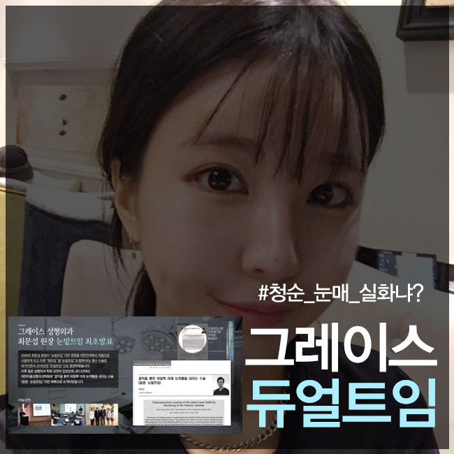 뒤트임,밑트임은 그레이스성형외과 듀얼트임으로! 관련 이미지 2