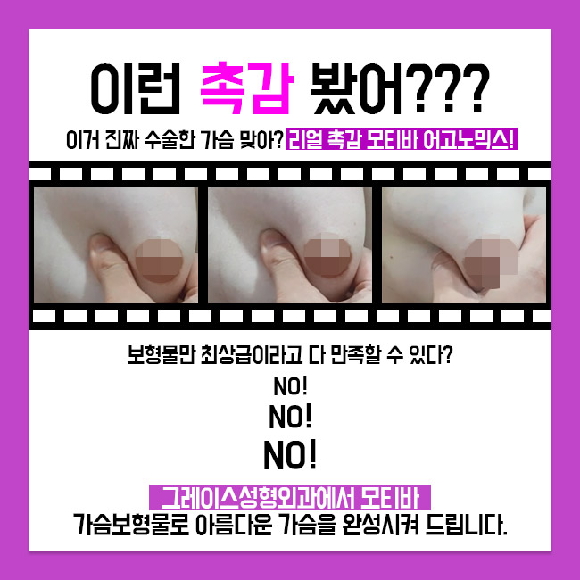 망설이다간 돌아오는 여름도 놓친다!! 그레이스성형외과 모티바 가슴성형 관련 이미지 2
