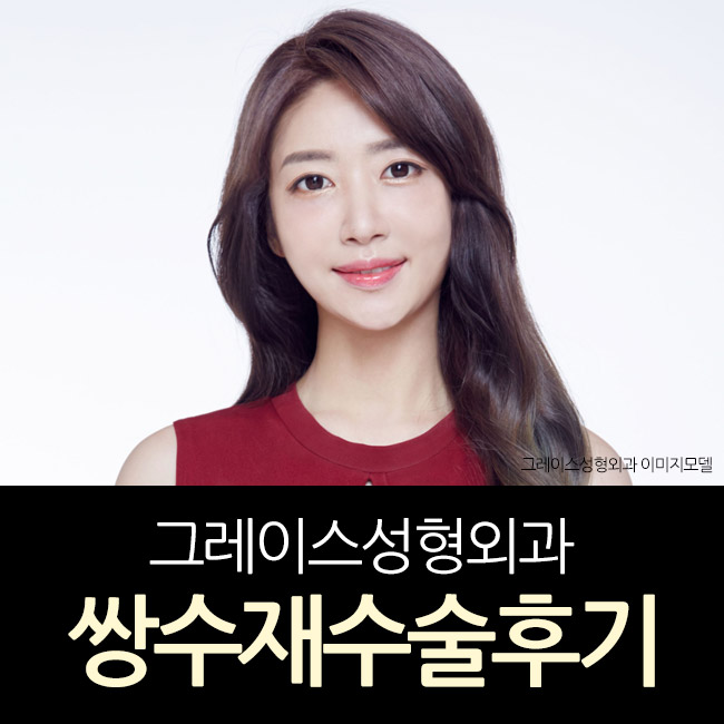 쌍수재수술후기 마지막 수술이 됩니다. 관련 이미지 2