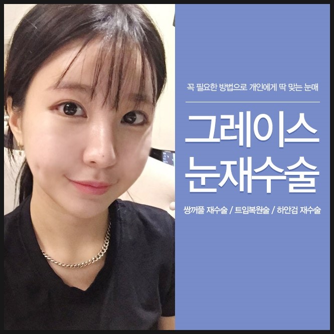 눈재수술은 신사역 그레이스성형외과에서 관련 이미지 1