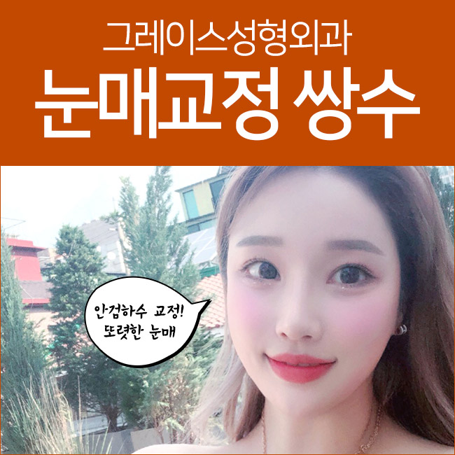 Defined Eyes with Ptosis Correction Double Eyelid Surgery! image 1