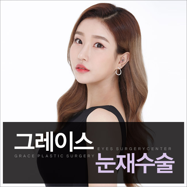 그레이스성형외과 눈재수술, 만족스러운 결과로 소문난 곳! 관련 이미지 3