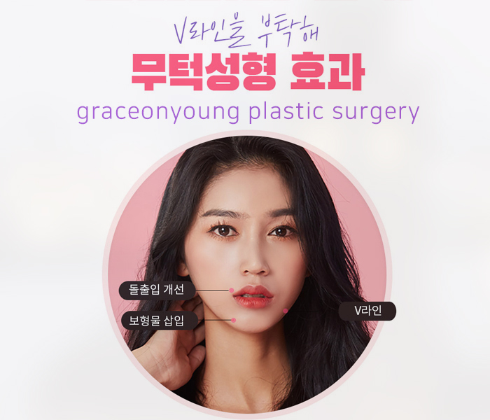 Chin Implant Surgery for a Natural Look, Even for Protruding Mouths image 4
