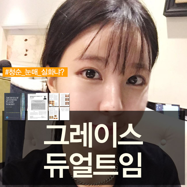 남다른 듀얼트임후기 부드럽고 청순한 인상으로 관련 이미지 5