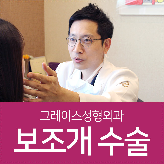 보조개수술로 상큼한 미소를 갖다♡ 관련 이미지 1