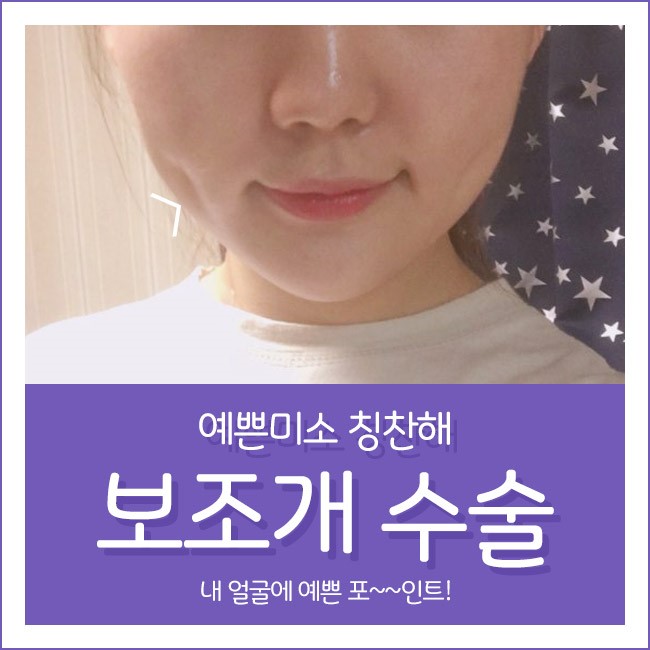 내 얼굴에 예쁜 포인트, 그레이스성형외과 보조개 수술 관련 이미지 3
