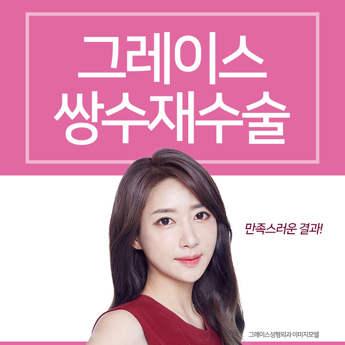 마지막 쌍수재수술 후기는 이곳에서 관련 이미지 4