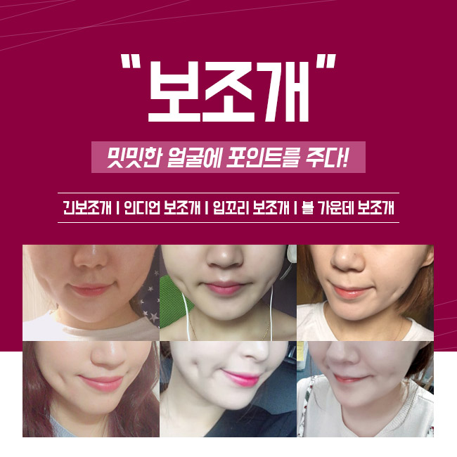 보조개수술후기, 그레이스성형외과에서 알아보자! 관련 이미지 1