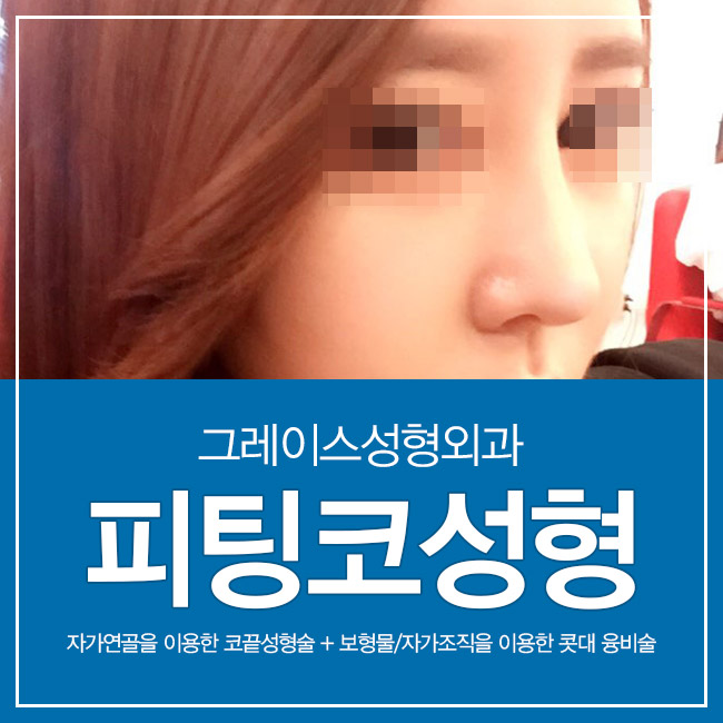 이런 코 갖고 싶지 않아? 그레이스성형외과 피팅코성형 관련 이미지 5
