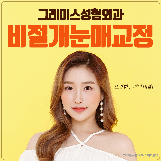 비절개눈매교정가격 바로 여기서 부담없이 관련 이미지 3