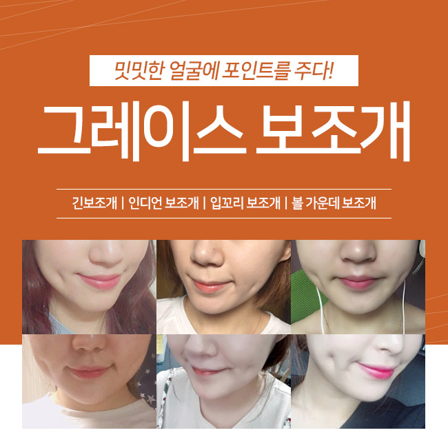 설렘을 주는 미소 보조개수술후기를 알아본다면 관련 이미지 5