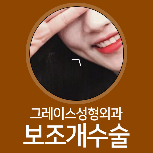 매력적인 이미지 변화는 보조개수술이 정답! 관련 이미지 2