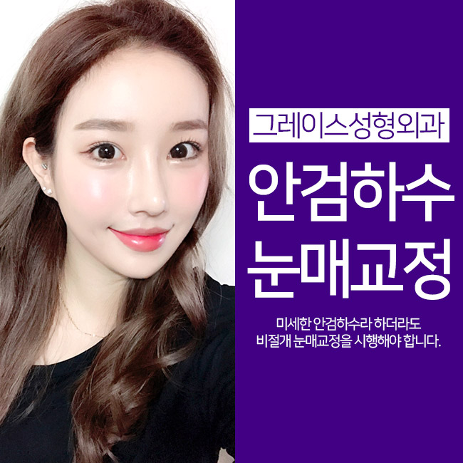 안검하수눈매교정, 또렷한 눈매로! 관련 이미지 1