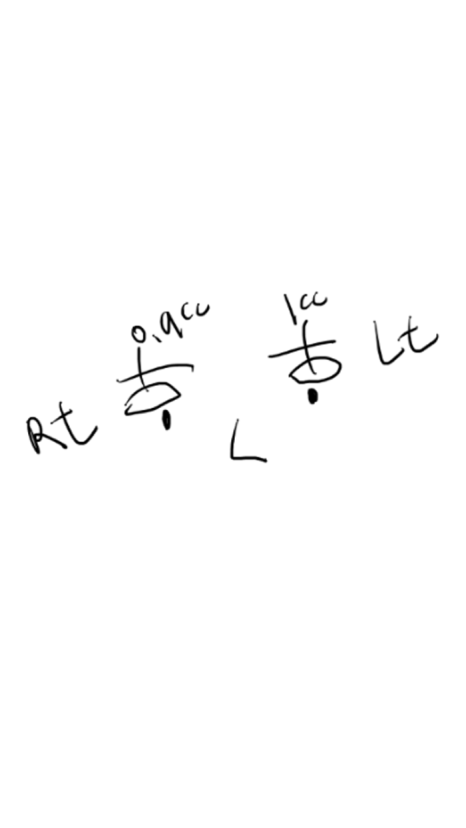 눈꺼풀 지방이식 후기처럼 자연스럽게 붓기&middot;흉터&middot;부작용 총정리 관련 이미지 2
