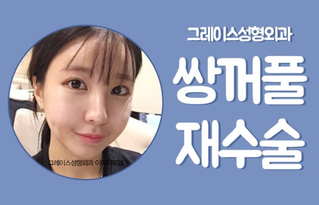 쌍꺼풀재수술은 신사역 그레이스성형외과에서! 관련 이미지 3