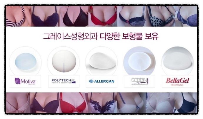 가슴재수술 그레이스성형외과에서 알아보자! 관련 이미지 4