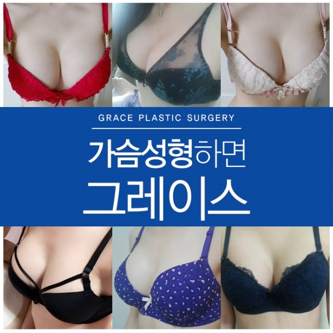 예쁜 볼륨감 가슴성형후기를 알아본다면? 관련 이미지 4