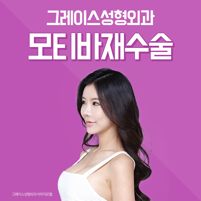 모티바재수술 만족스러운 후기 관련 이미지 4