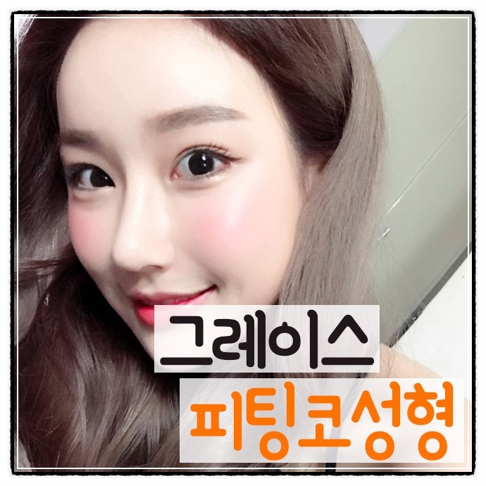 코성형비용 부담없고 합리적인 가격으로 관련 이미지 5