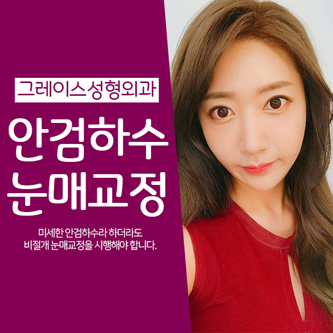 안검하수눈매교정, 또렷한 눈매로! 관련 이미지 5