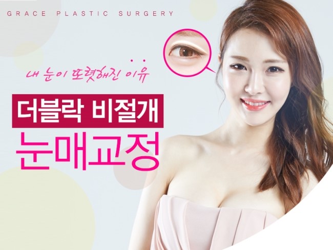 눈매교정은 신사역 그레이스성형외과 더블락비절개눈매교정 관련 이미지 1