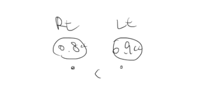 Eyebrow Fat Grafting &middot; Eyelid Fat Grafting &middot; Sunken Eyes Surgery Cost Information (As of June 2025) image 2