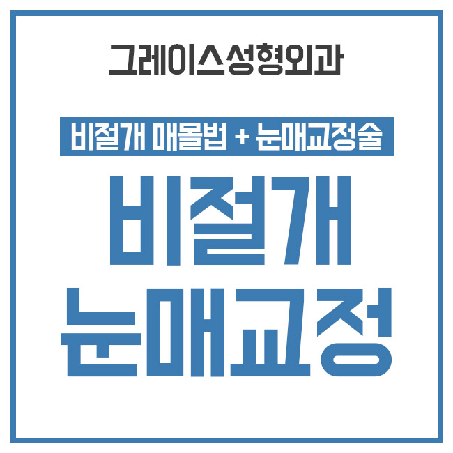 또렷한 눈매, 비절개눈매교정가격을 알아본다면 관련 이미지 3